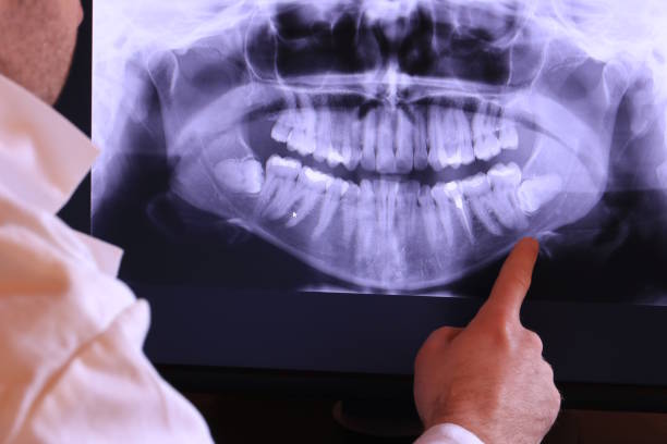 Best Emergency Tooth Extraction in South Lyon, MI