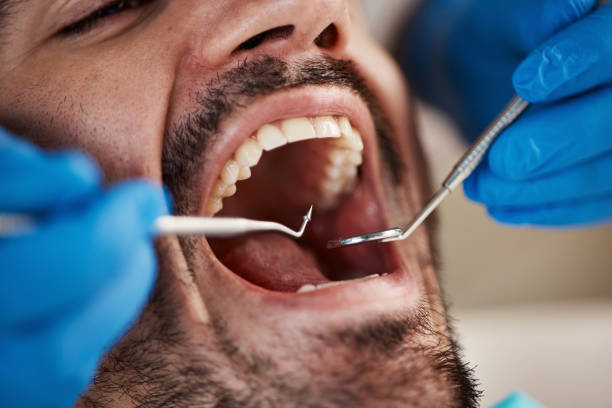 Best Emergency Wisdom Teeth Removal in South Lyon, MI